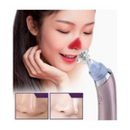 Electric Blackhead Remover – USB Rechargeable Vacuum Pore Cleaner
