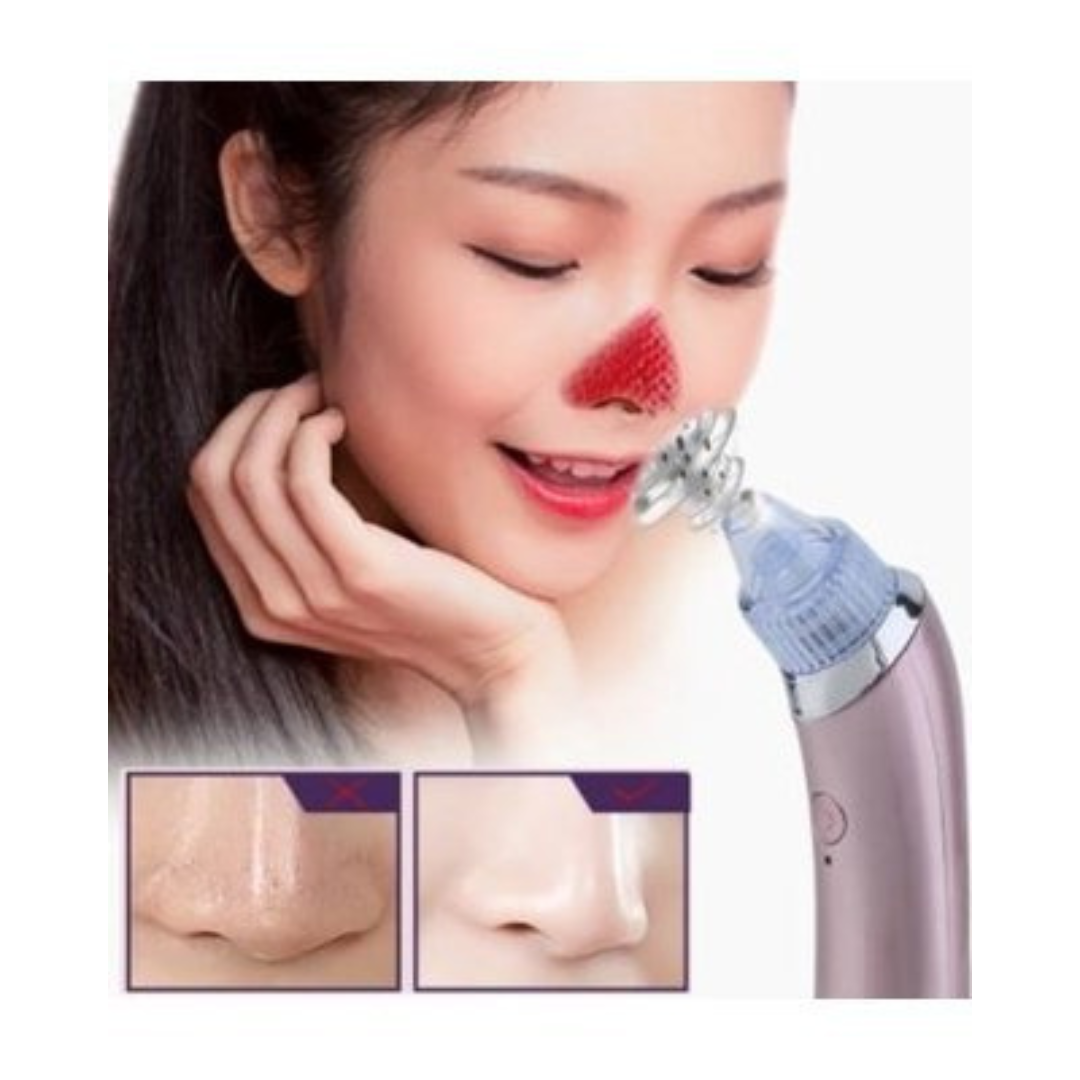 Electric Blackhead Remover – USB Rechargeable Vacuum Pore Cleaner