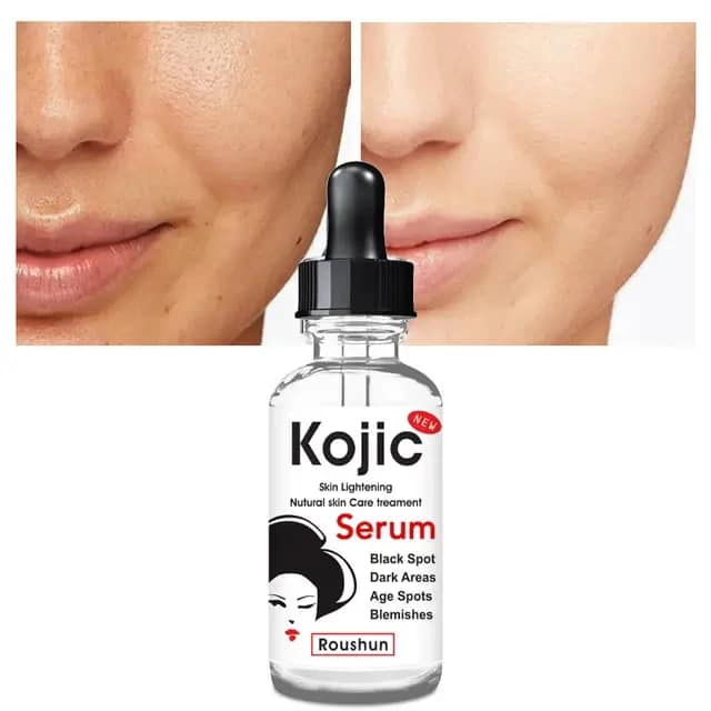 ROUSHUN Kojic Skin Lightening Black Spot Face Serum – image 4