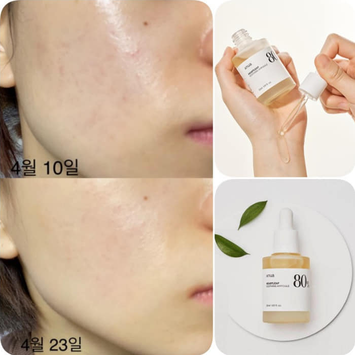 Anua Heartleaf 80% Soothing Ampoule ingredients and benefits