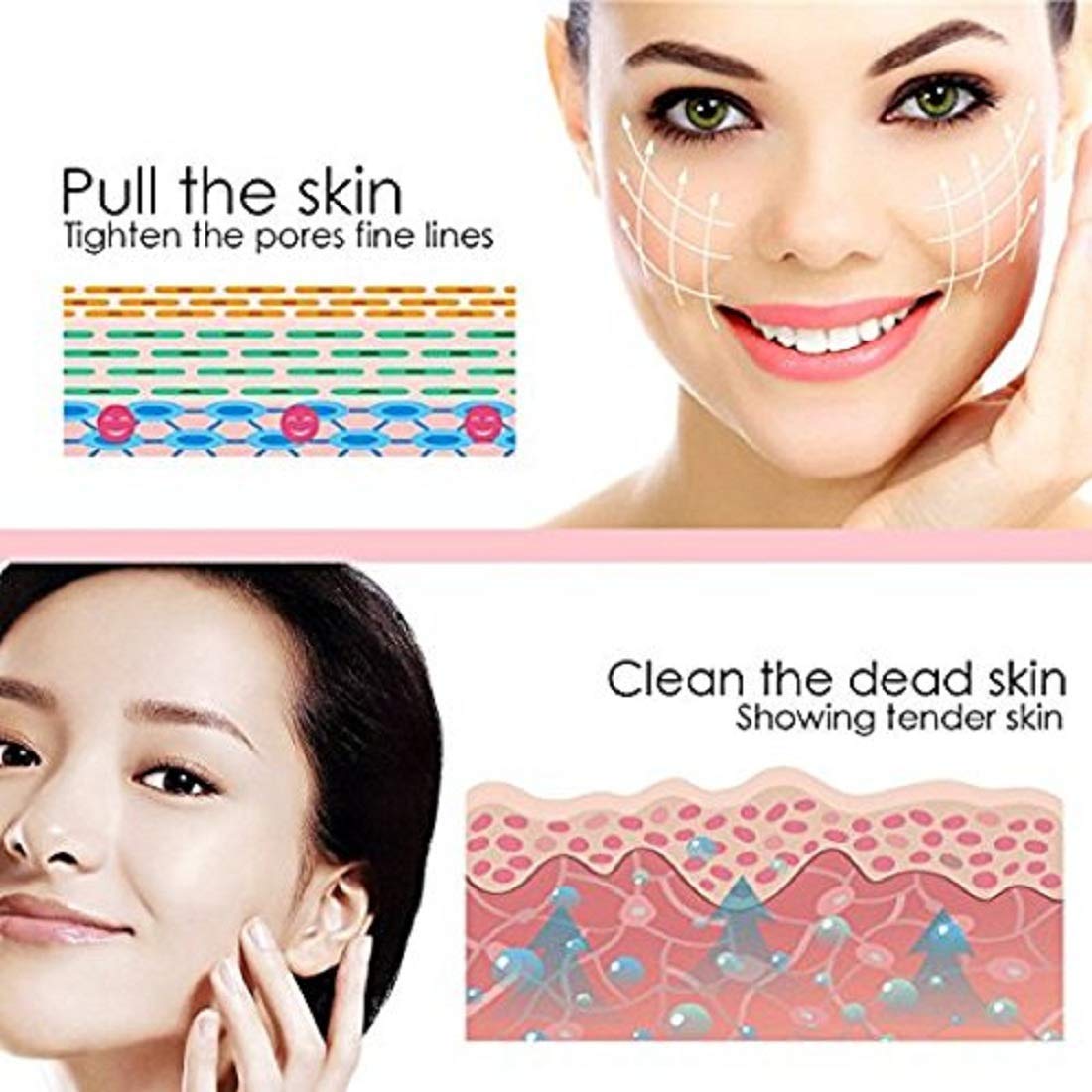 Electric Blackhead Remover – USB Rechargeable Vacuum Pore Cleaner