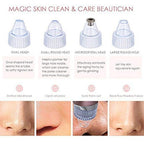 Electric Blackhead Remover – USB Rechargeable Vacuum Pore Cleaner