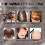 Rosemary Hair Growth Oil – image 9