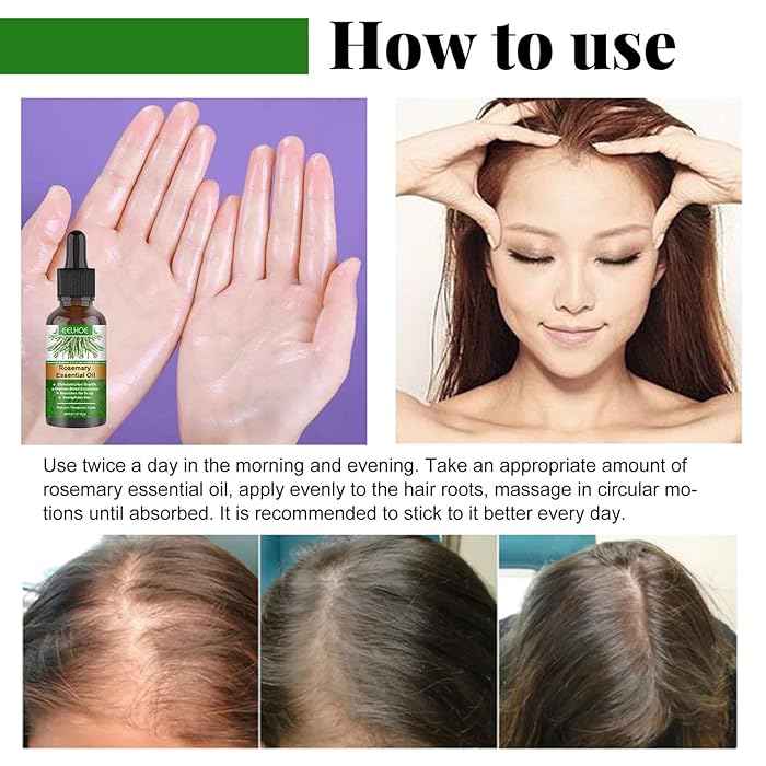 Rosemary Hair Growth Oil – image 10
