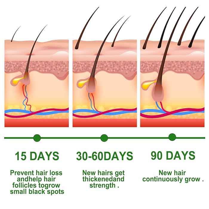 Rosemary Hair Growth Oil – image 6
