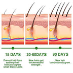 Rosemary Hair Growth Oil – image 6
