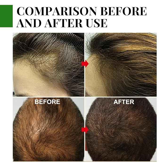 Rosemary Hair Growth Oil – image 8