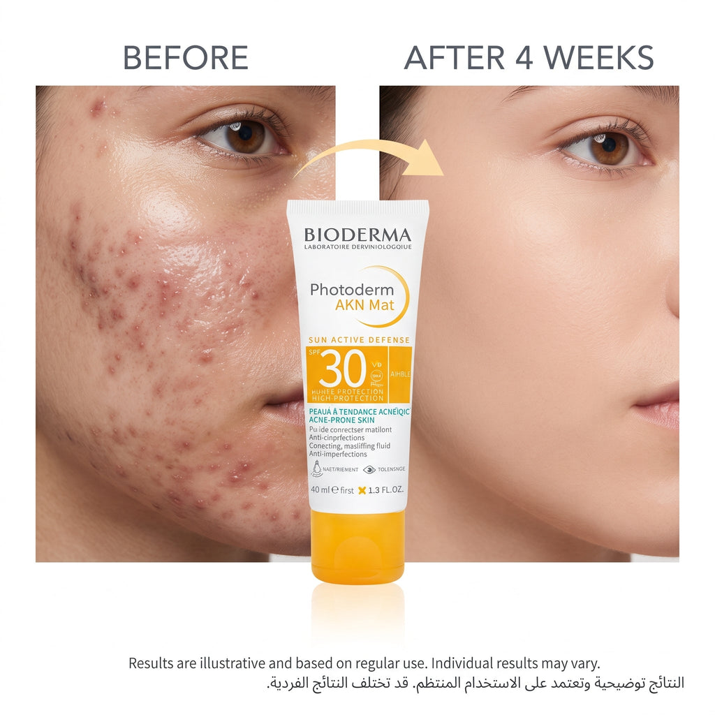 Bioderma Photoderm AKN Mat SPF 30