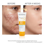 Bioderma Photoderm AKN Mat SPF 30