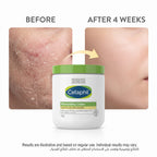 Cetaphil Moisturising Cream 550g – Face & Body for Dry, Sensitive Skin