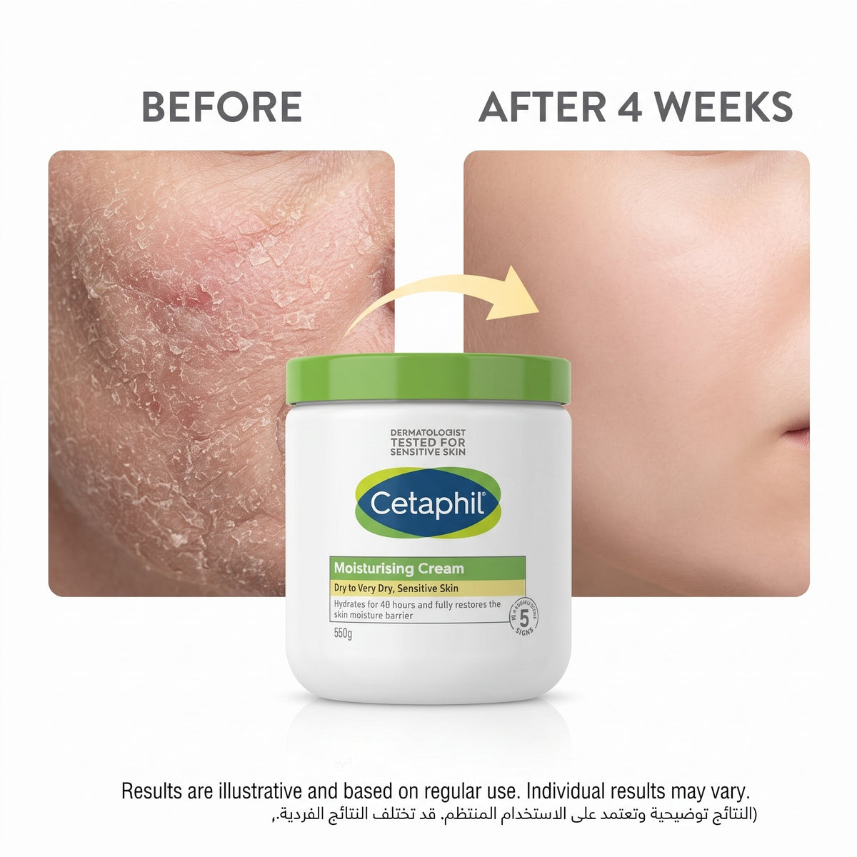 Cetaphil Moisturising Cream 550g – Face & Body for Dry, Sensitive Skin