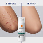 La Roche-Posay Anthelios Oil Correct SPF 50+ 50ml – Matte Anti-Blemish Sunscreen for Oily Skin