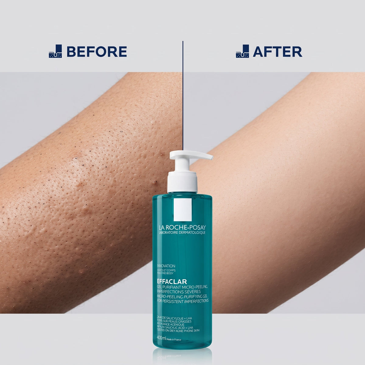 La Roche-Posay Effaclar Micro-Peeling Purifying Gel 400ml – image 6