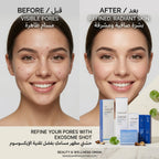 Medicube Zero Pore & Advanced Exosome Shot Set, Korean pore-refining skincare set (view 2)