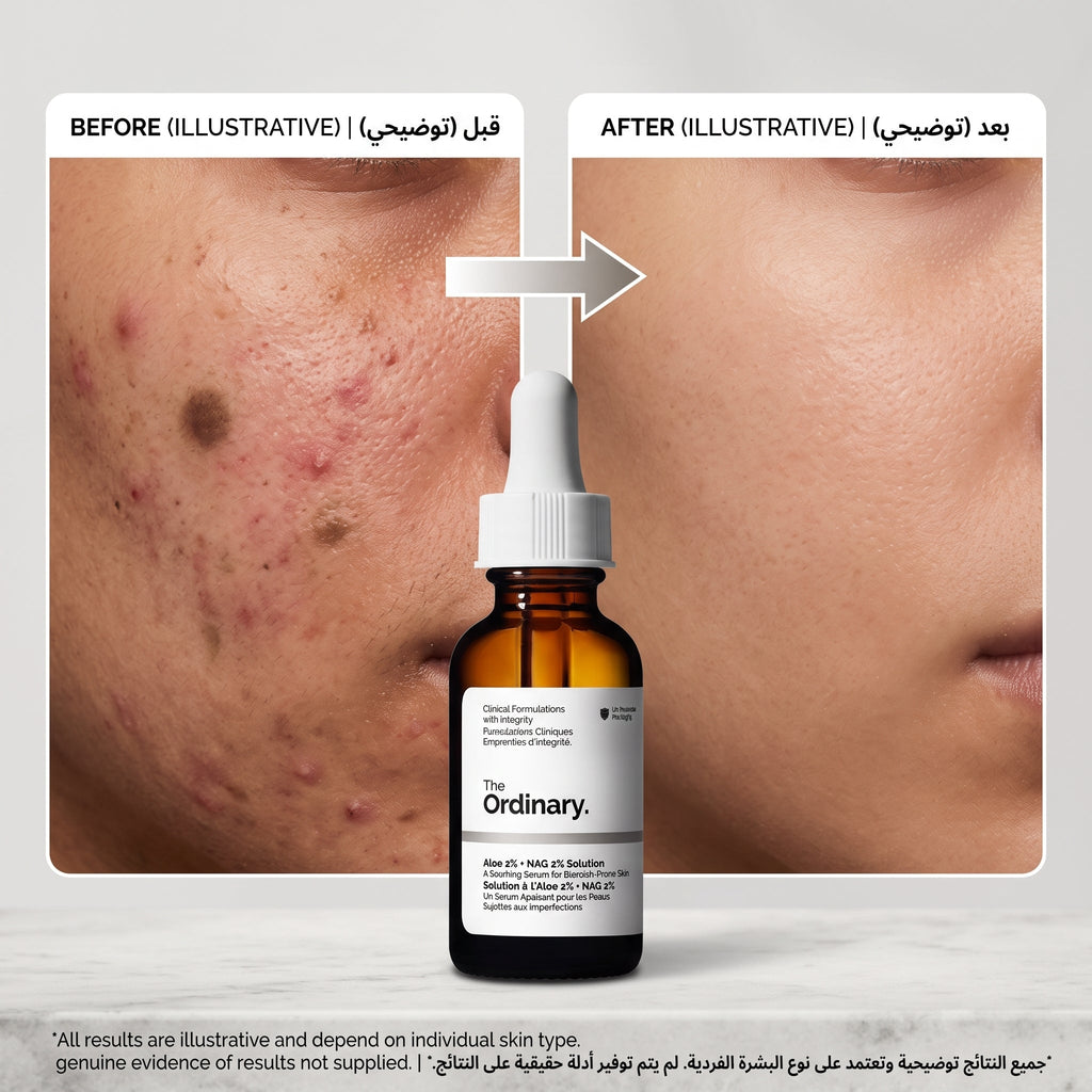 The Ordinary Salicylic Acid 2% Solution 30ml – image 5