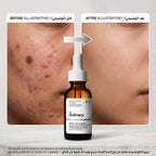 The Ordinary Salicylic Acid 2% Solution 30ml – image 5