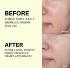 Celimax The Vita-A Retinol Shot Tightening Serum