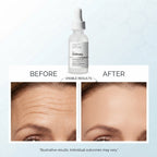 The Ordinary Argireline Solution 10% 30ml – image 7