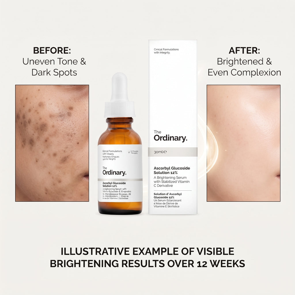 The Ordinary Ascorbyl Glucoside Solution 12% 30ml – image 5