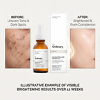 The Ordinary Ascorbyl Glucoside Solution 12% 30ml – image 5