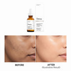 The Ordinary Ascorbyl Tetraisopalmitate 20% in Vitamin F 30ml – image 5