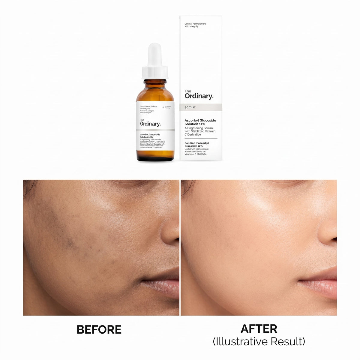 The Ordinary Ascorbyl Tetraisopalmitate 20% in Vitamin F 30ml – image 5