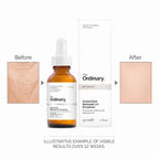 The Ordinary Granactive Retinoid 2% Emulsion packaging