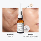 The Ordinary Mandelic Acid 10% + HA benefits