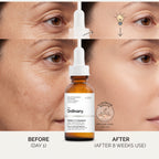 The Ordinary Retinol 1% in Squalane 30ml – image 4