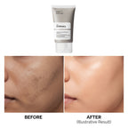 The Ordinary Vitamin C Suspension 30% in Silicone 30ml – image 5