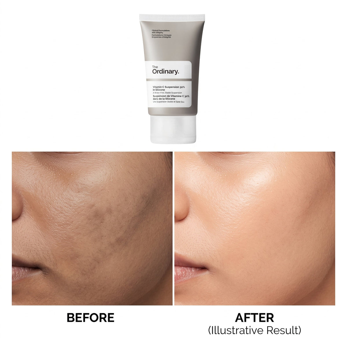 The Ordinary Vitamin C Suspension 30% in Silicone 30ml – image 5